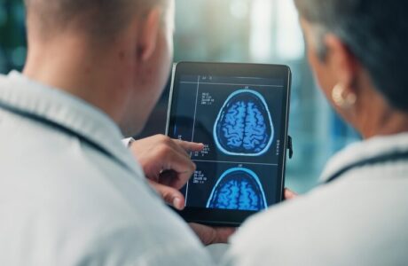 Studio sulla fibrillazione atriale e declino cognitivo