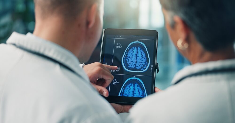 Studio sulla fibrillazione atriale e declino cognitivo